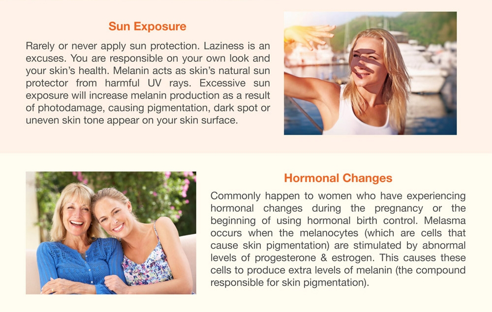 What Causes Pigmentation, Dark Spot & Uneven Skin tone?